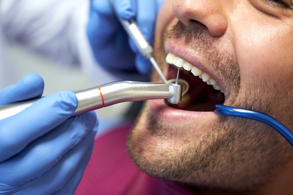 przyczyny i możliwości leczenia próchnicy zębów