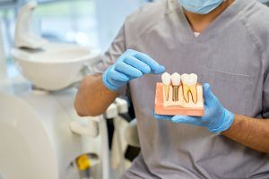 Co to jest implant zębowy? Na co zwrócić uwagę korzystając z implantologii stomatologicznej w Kielcach.